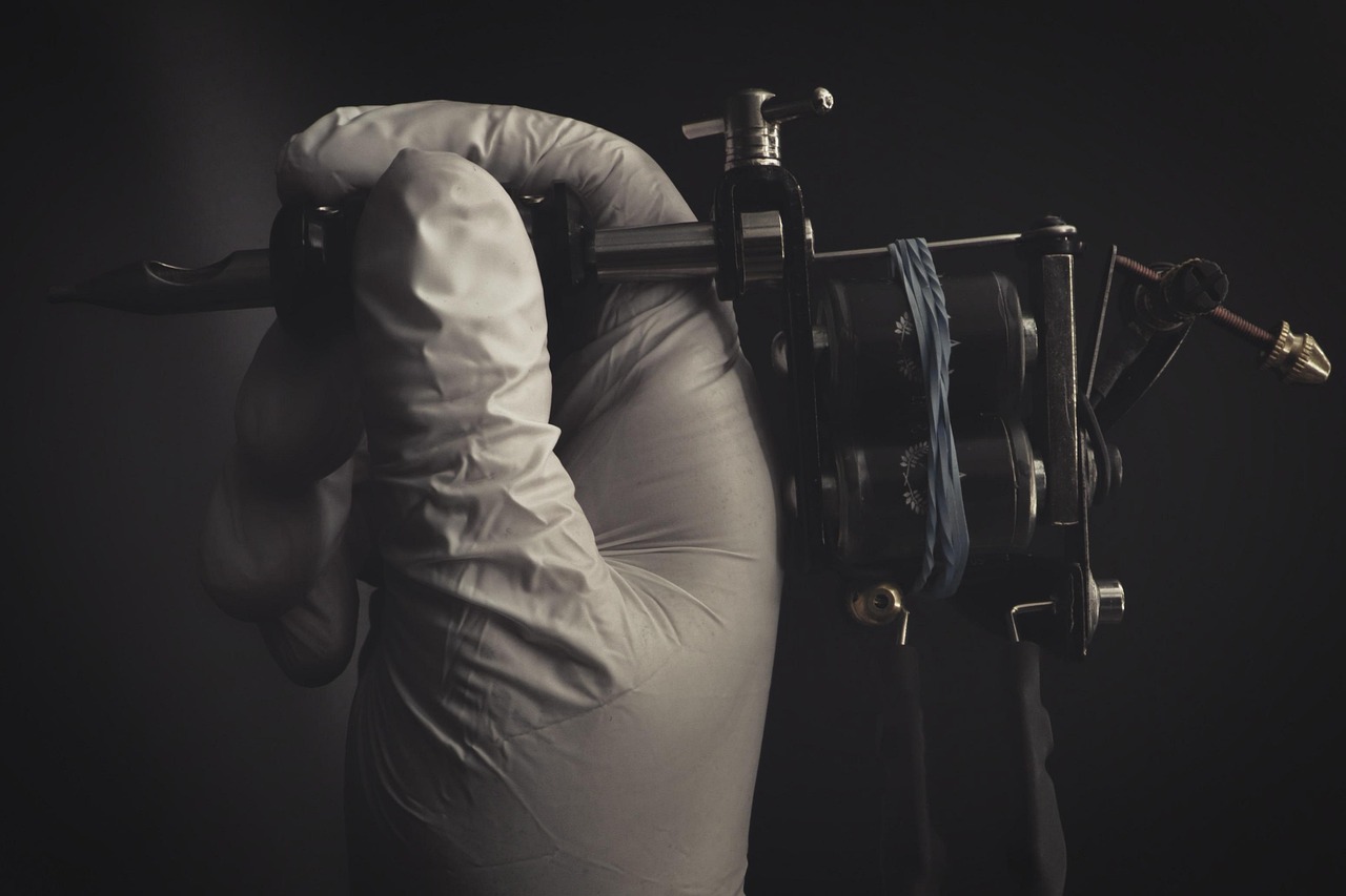 Unveiling the Journey of Tattoo Erasure: A Comprehensive Guide to Tattoo Removal